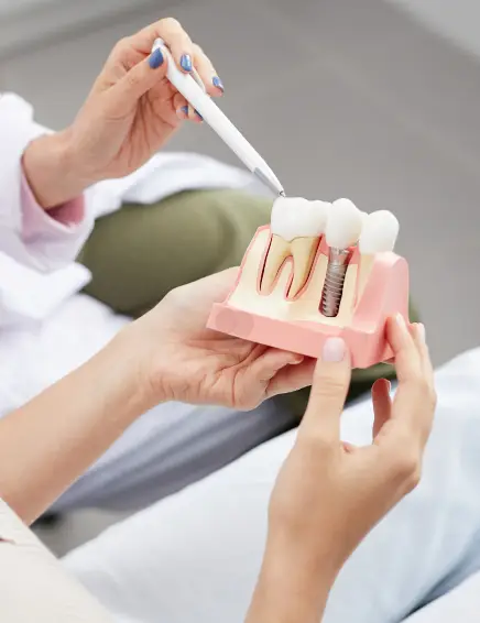 Dental Implants in Osborne Park