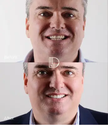 cosmetic dentistry in Osborne Park.