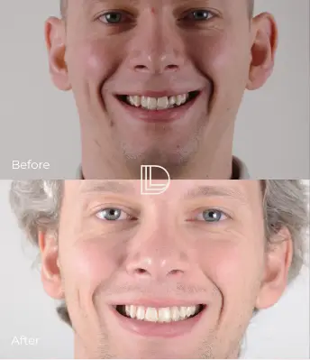 Before after transformation