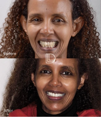 cosmetic dentistry in Osborne Park.