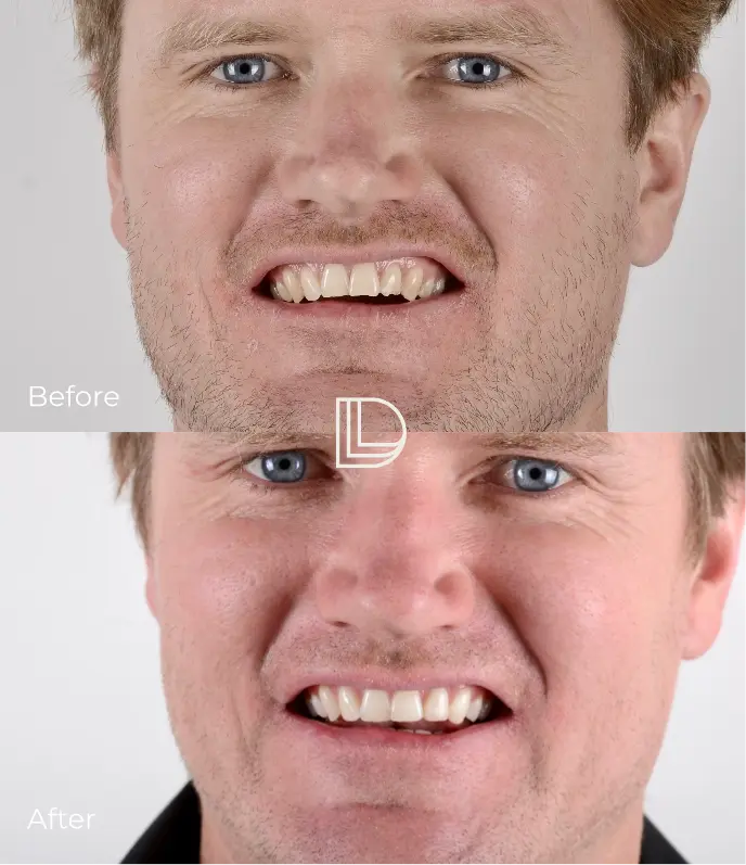 Cosmetic Dentistry Services