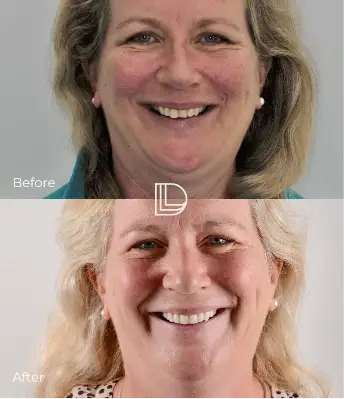 Smile Transformations