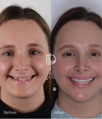 Smile Transformations