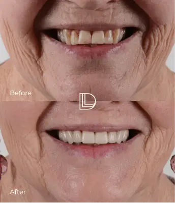 Before after transformation