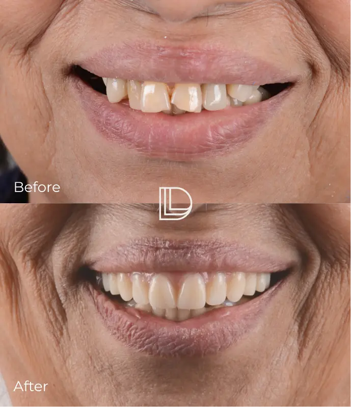 Smile Transformations