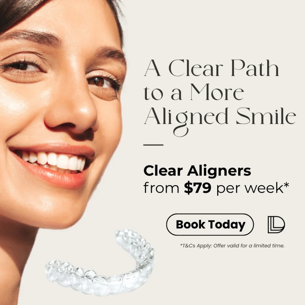 aligner-offer